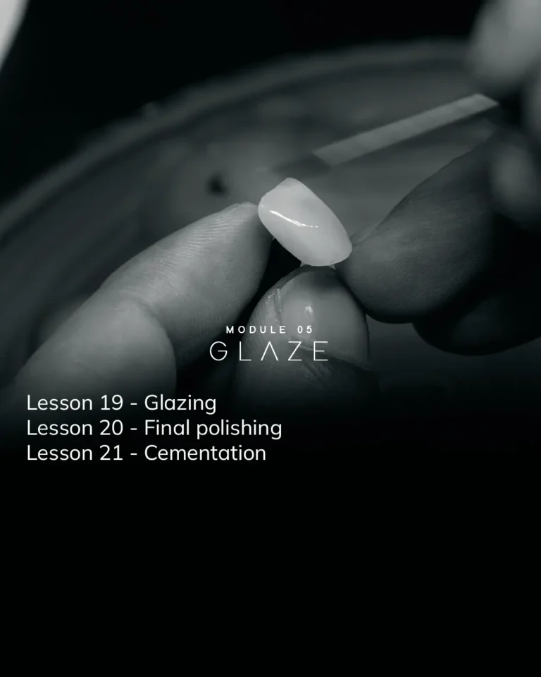 Módulo 05 - Glaze (2)